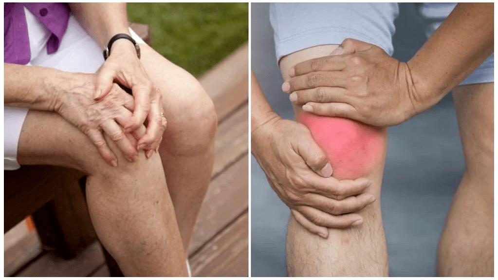 Третман на артроза