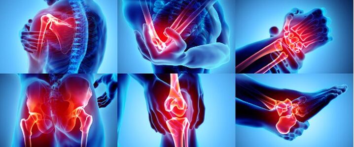 Воспалени зглобови